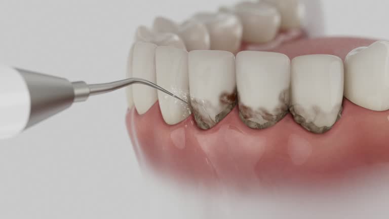 Reliable Dental Implants contractor in Englewood, CO by Smile Center Dentistry